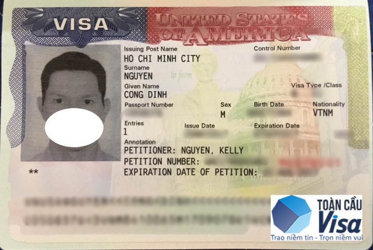 Visa của anh Định